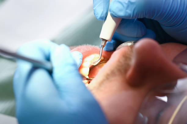 Best Holiday Emergency Dentist in Eerlin, ND