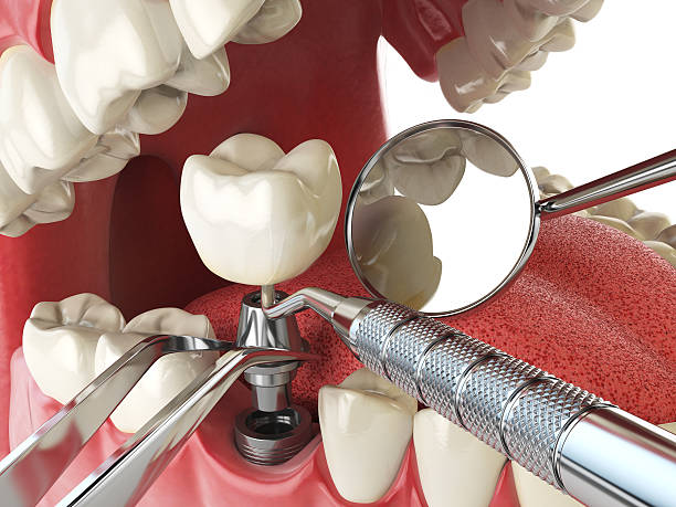 Best Pediatric Emergency Dentist in Eerlin, ND