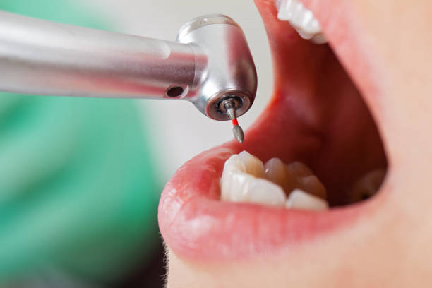 Best Emergency Dental Care for Abscessed Tooth in Eerlin, ND